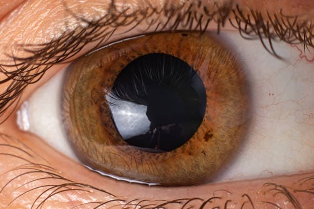 Cornea Transplant cost in Iran
