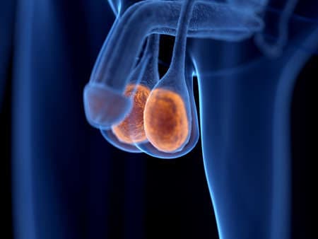 Who needs testicular surgery?