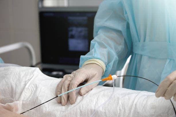 What is Arrhythmia Surgery?