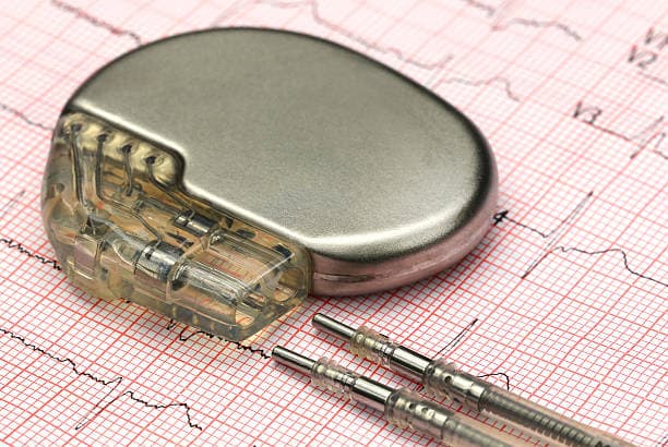 Pacemaker risks & benefits