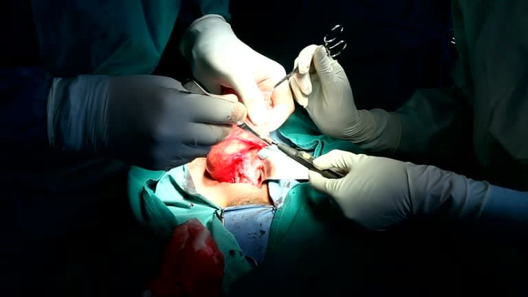 Who needs hernia repair?