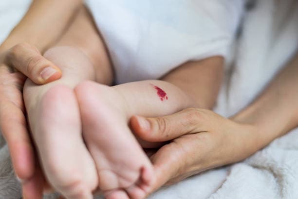 How is a hemangioma diagnosed?