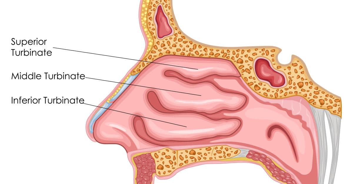 What is Turbinoplasty?