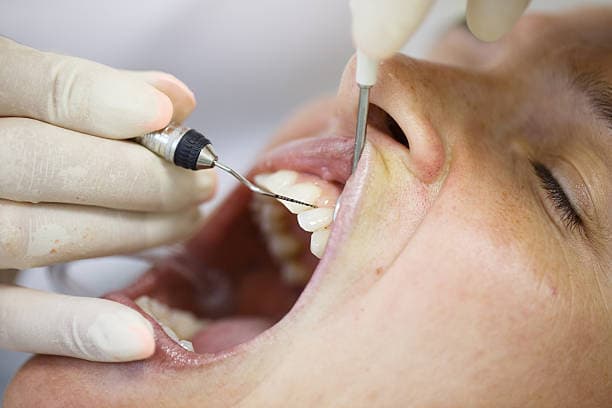 Periodontal disease treatment 