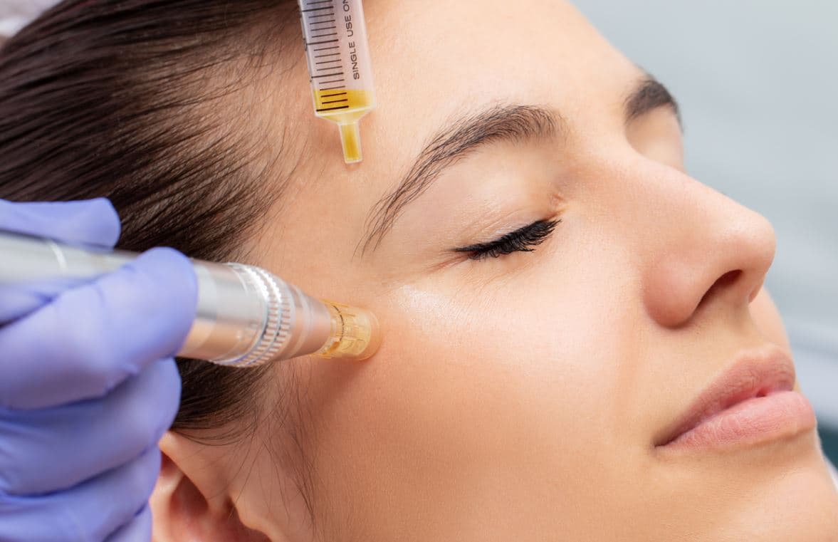 Who's a good candidate for mesogel treatment?