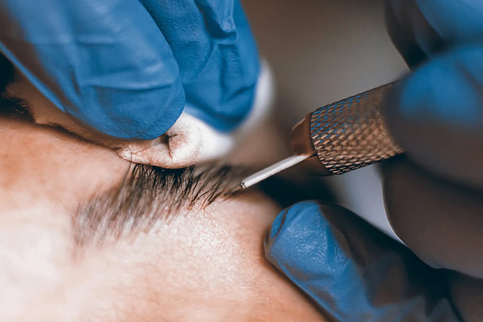 Who can get Microblading?