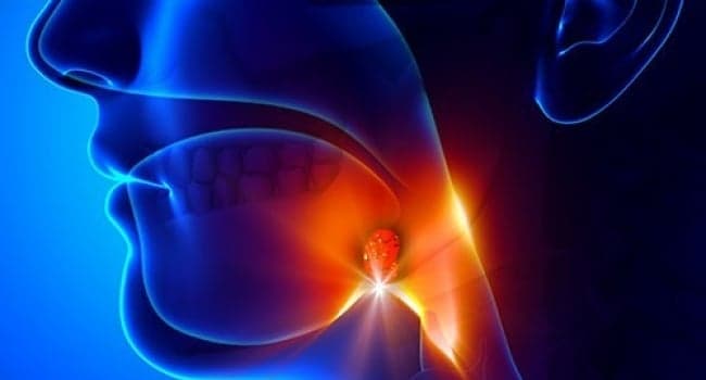 Adenoidectomy cost in Iran