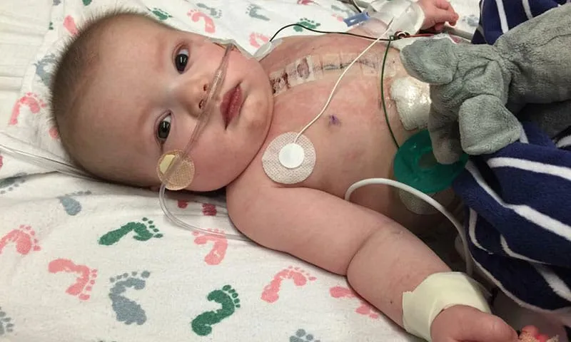 Single ventricle heart defect treatment cost in Iran