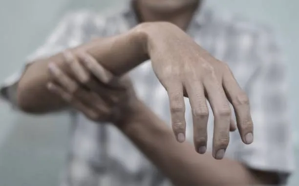 Radial Nerve Repair Cost in Iran 