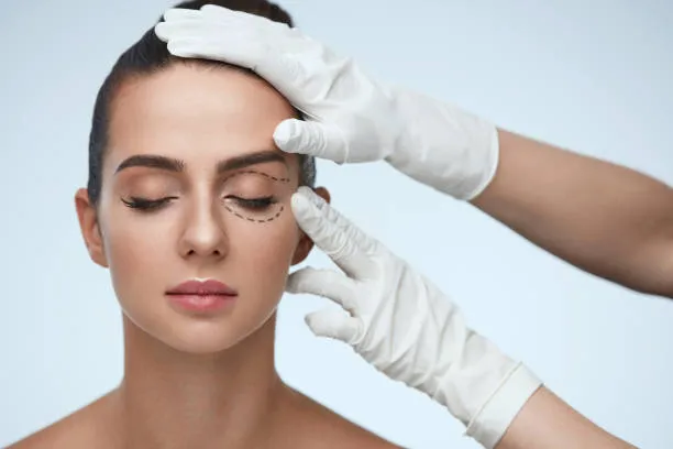 Blepharoplasty Procedure in Iran 