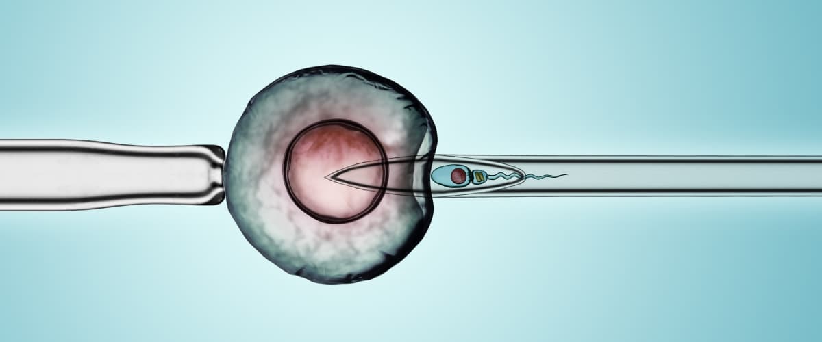 ICSI Success Rates in Iran 