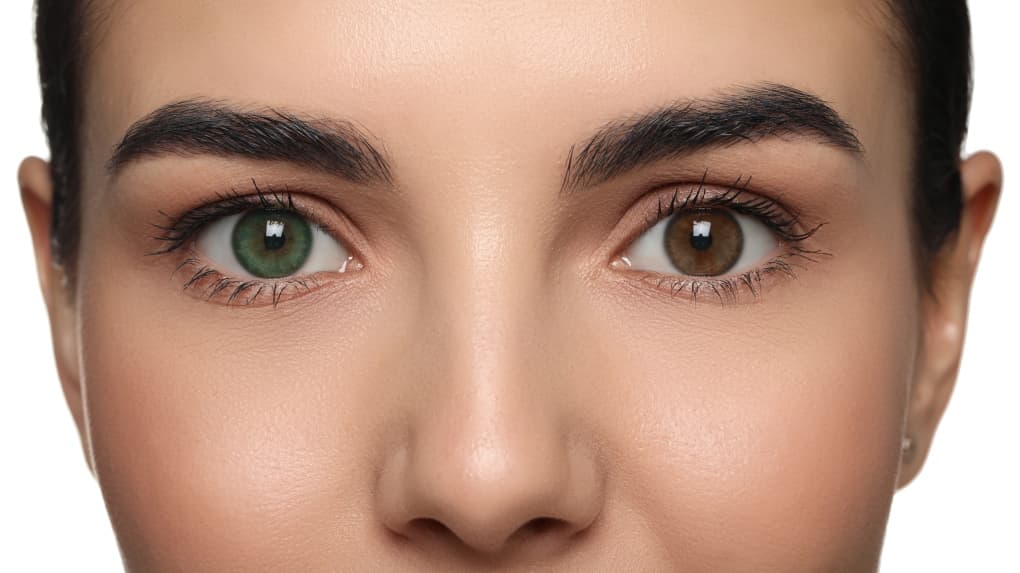 What is Eye Color Change Surgery?