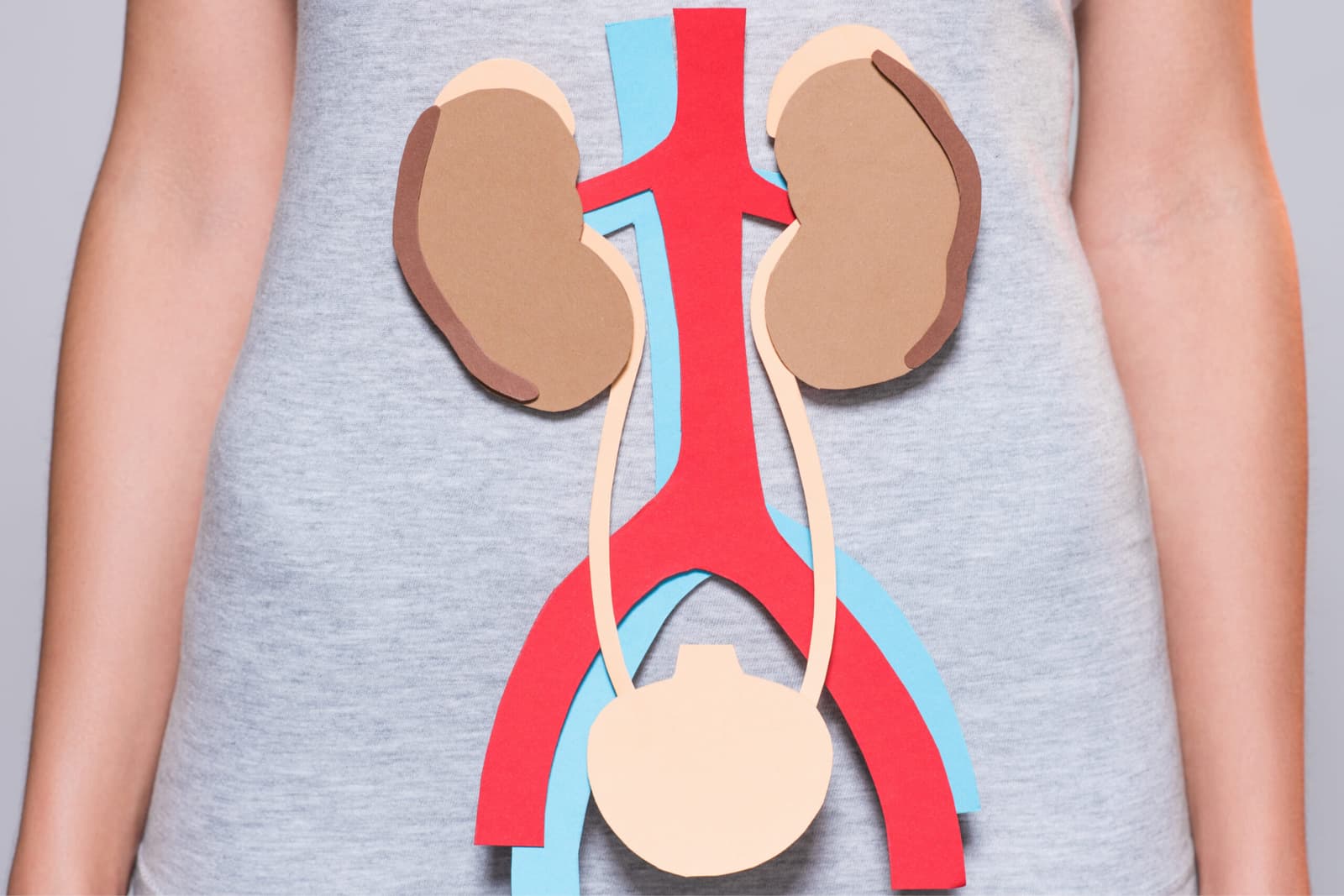 What is Pyeloplasty?