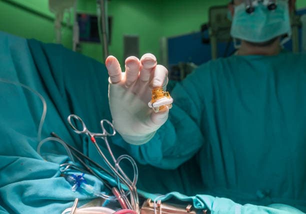 Who needs an Aortic Surgery?