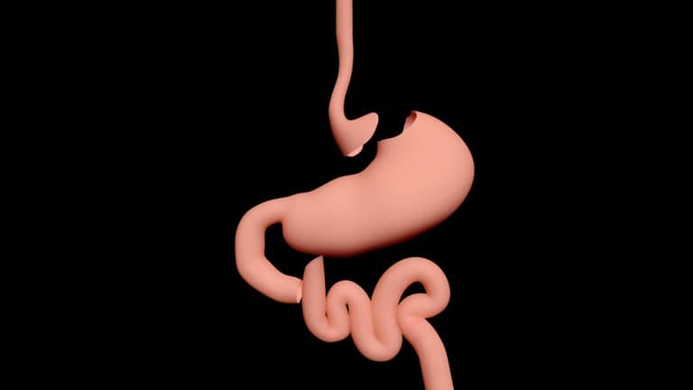 Diet before gastric bypass