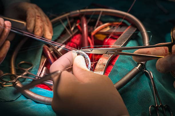 When is heart valve repair or replacement necessary?