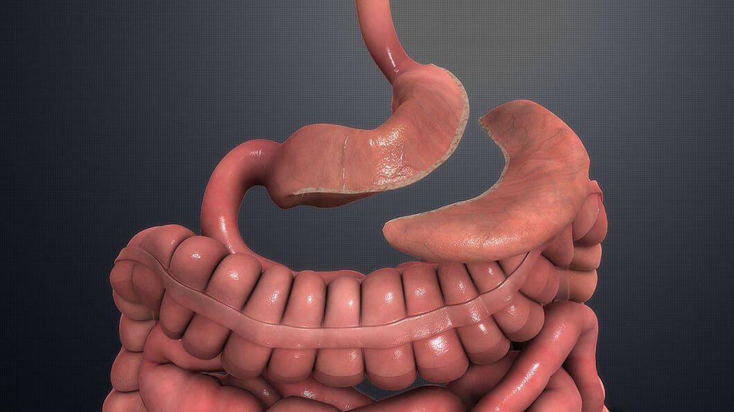 Gastrectomy