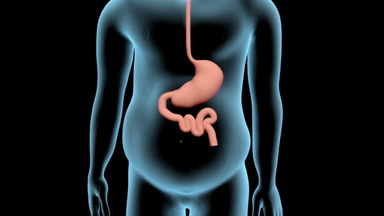 What is Gastrectomy?