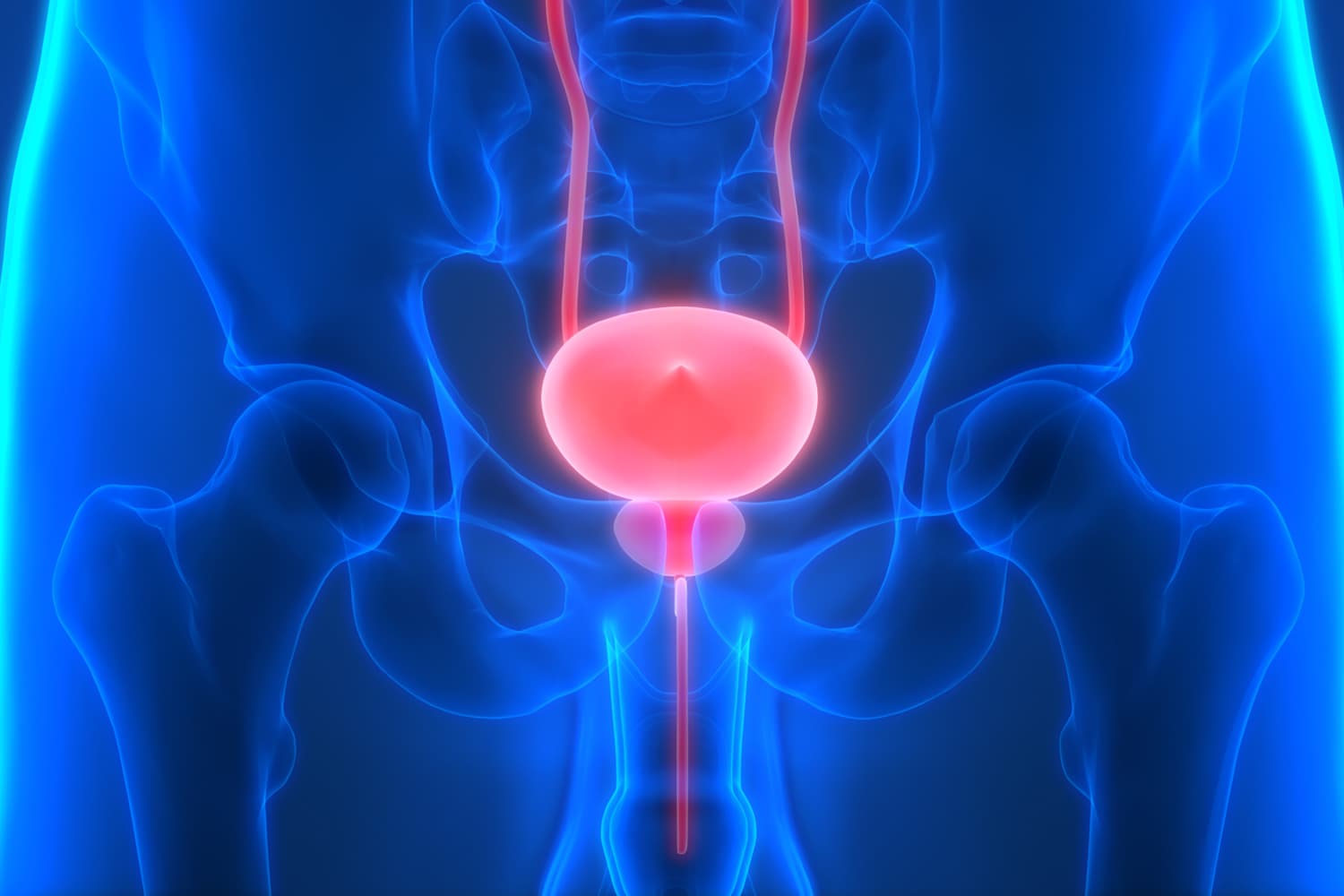 What is a bladder removal procedure?