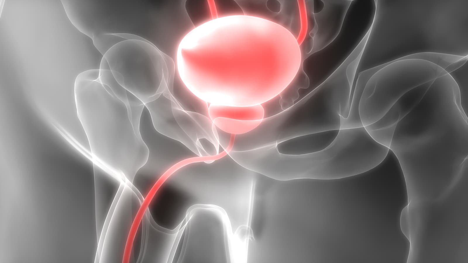 What are the risks of bladder removal surgery?