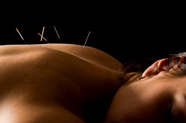 What does acupuncture treat?