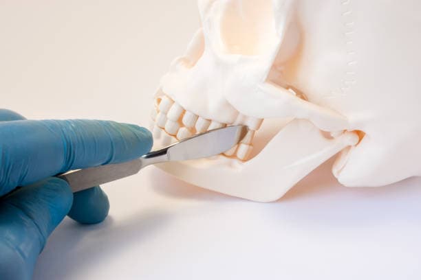 What conditions does jaw surgery treat?