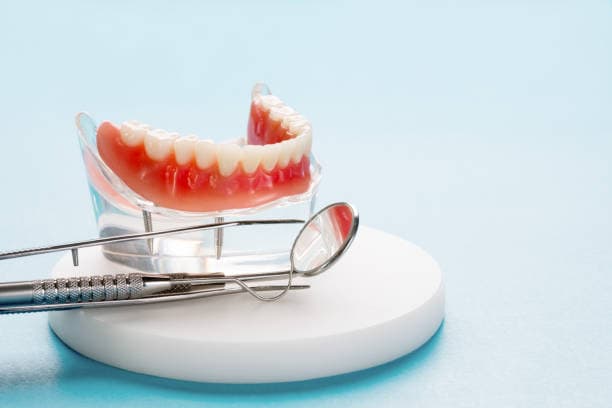 What are dentures?