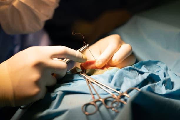 Why is surgery for arrhythmia necessary?