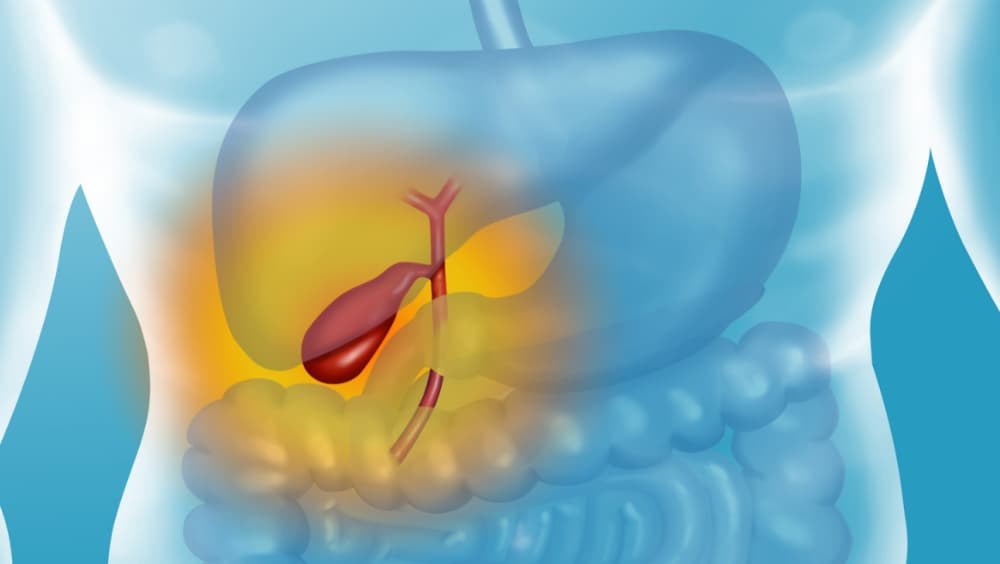 What happens during a cholecystectomy?