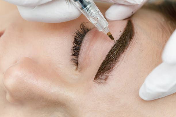 Eyebrow Tattoo removal