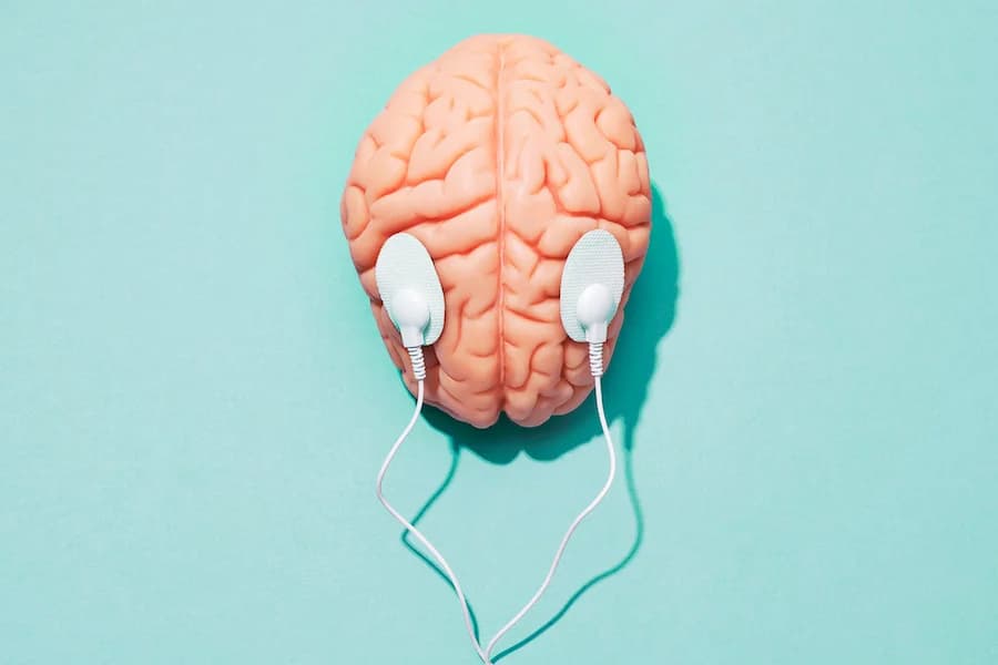 What Causes Epilepsy?