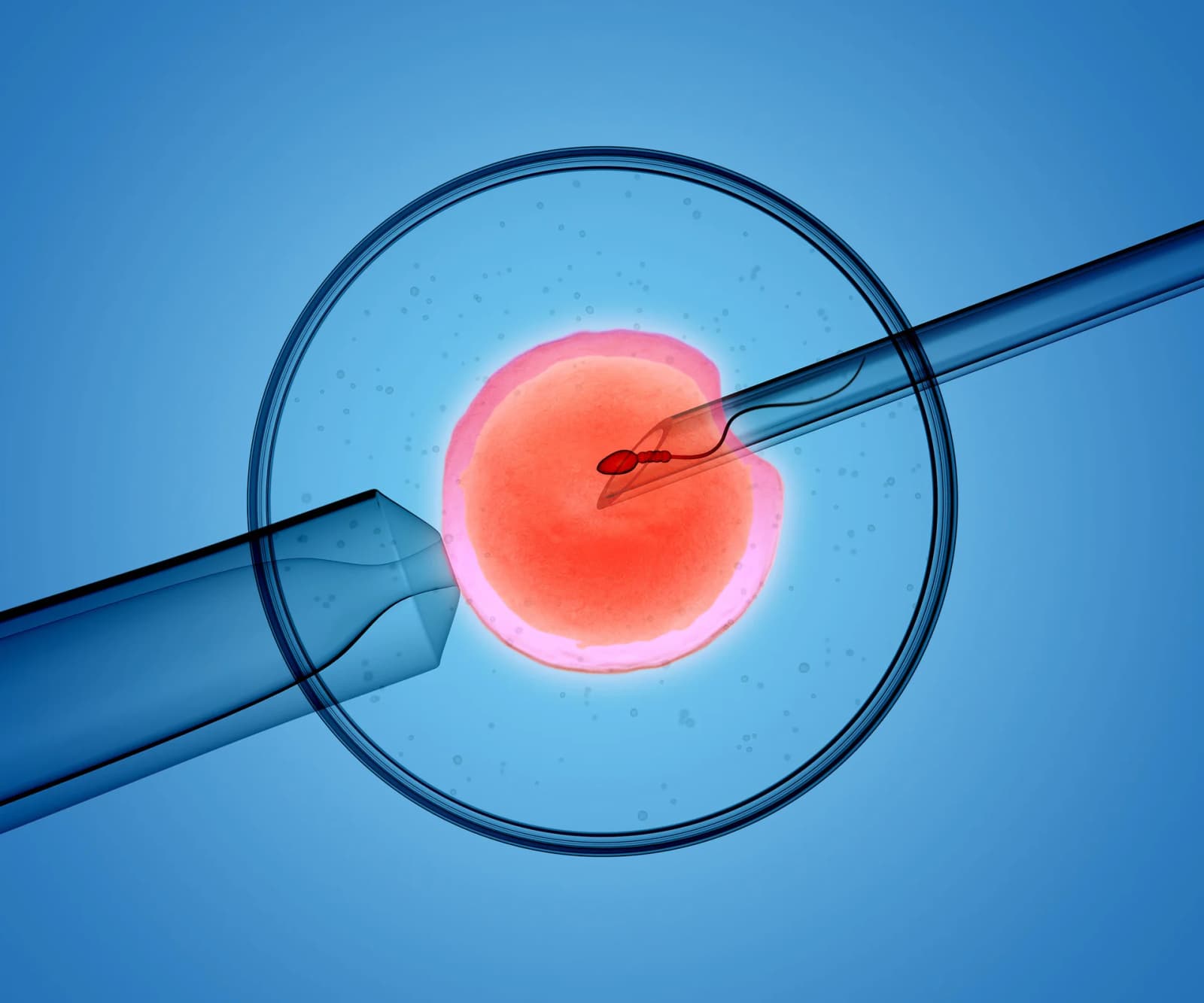 Female Infertility: Cause & Treatment