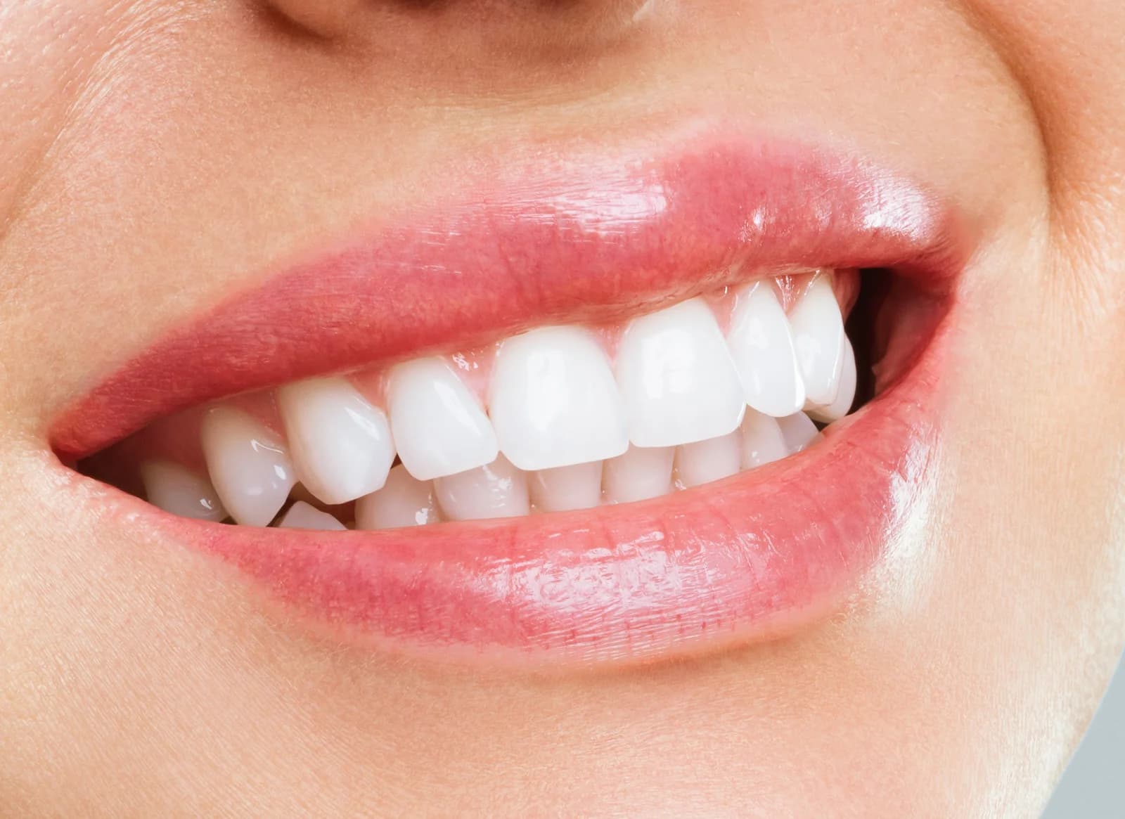 Teeth Whitening vs. Teeth Bleaching