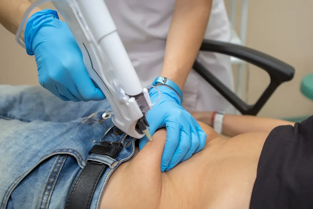 The role of Carboxytherapy in dermatology