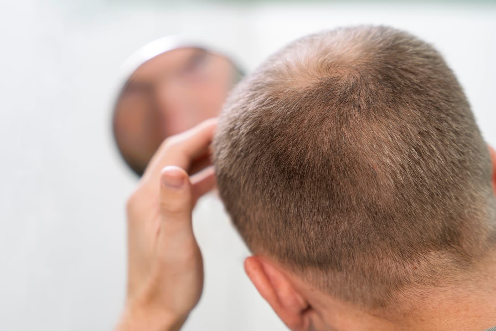 Methods Used for Hair Transplantation