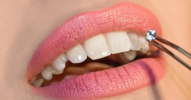 Choosing your tooth gem