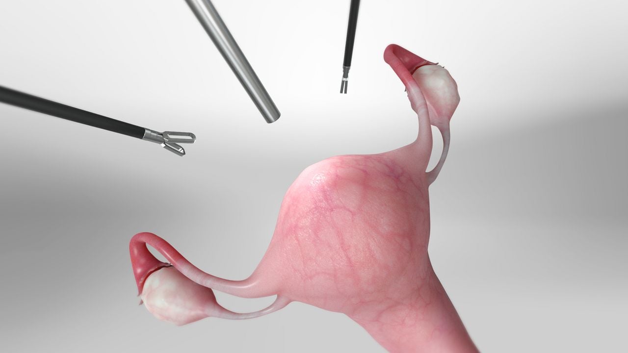 What is a Hysterectomy?