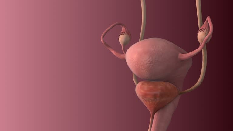 What is a bladder removal?