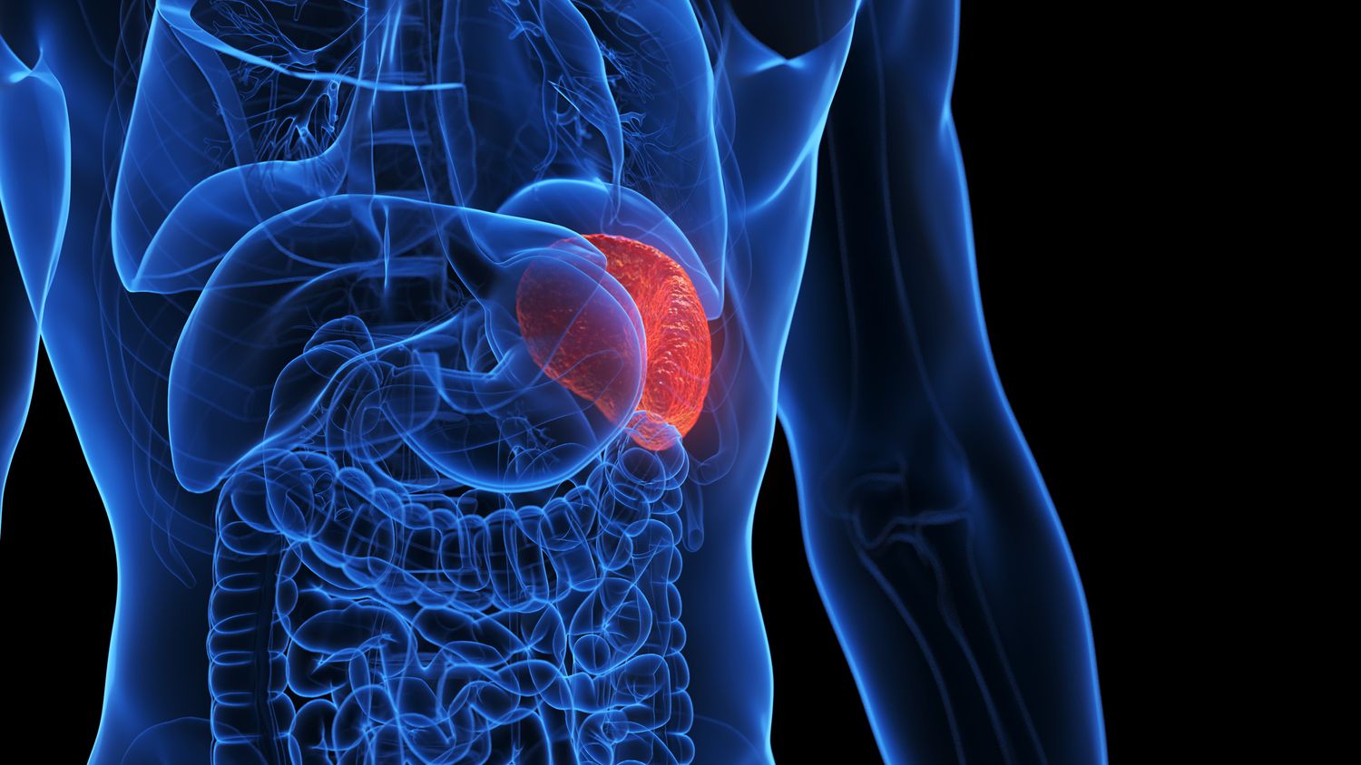 Why would I need a Splenectomy?