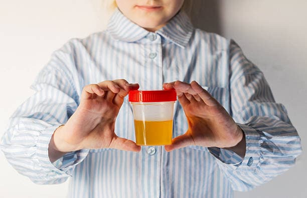 Pediatric Urology treatment cost in Iran