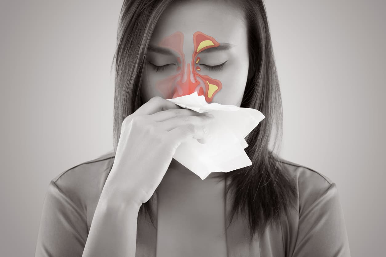 Sinusitis Treatment