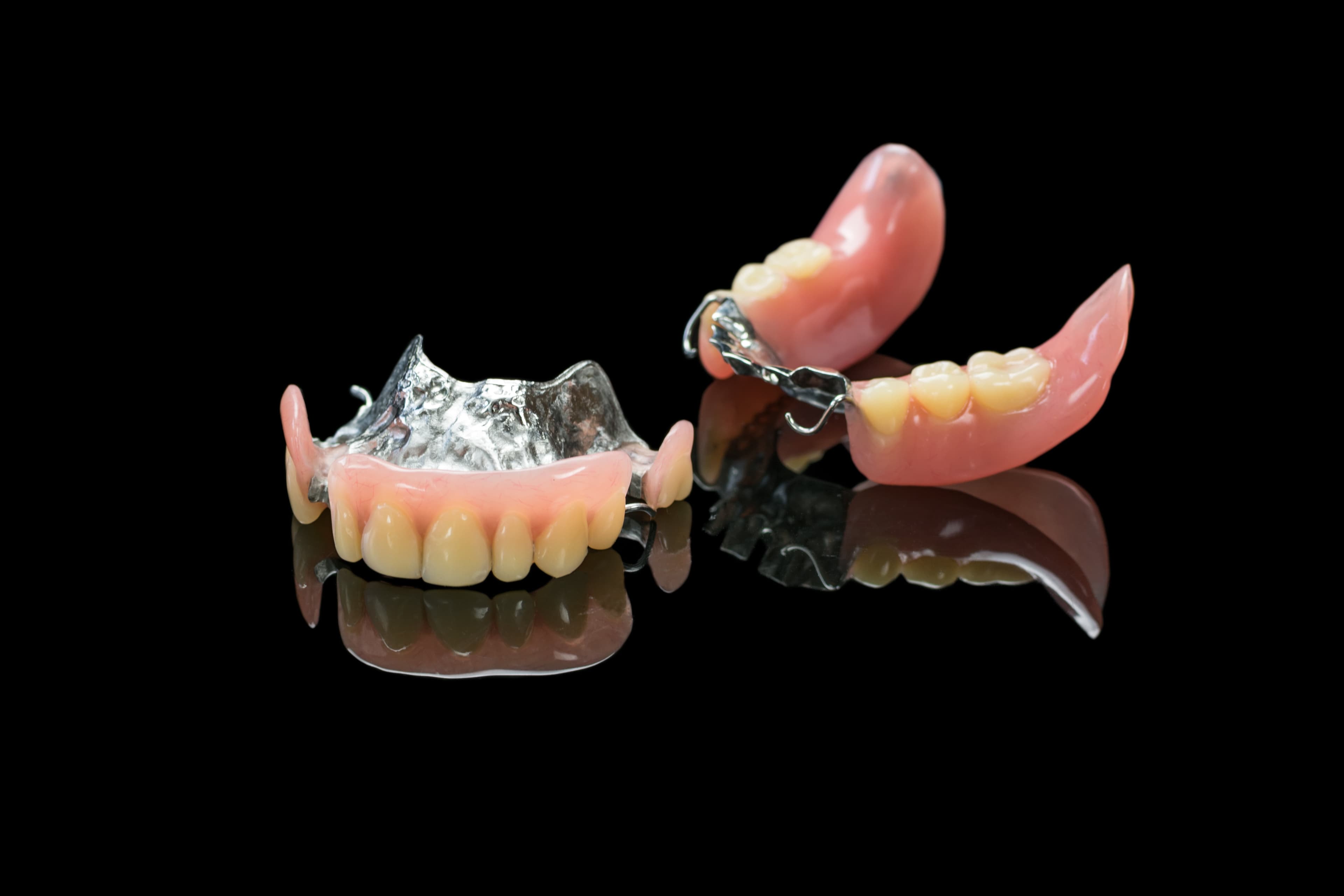 What happens during a denture fitting?