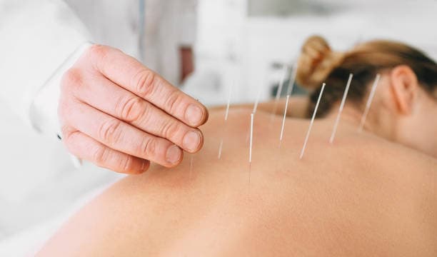 What are the risks & benefits of acupuncture?