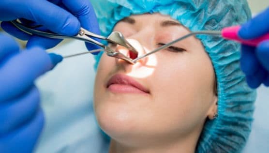 Turbinate reduction recovery process