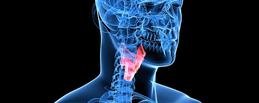 Why would you need a laryngectomy?