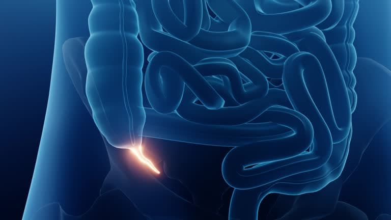 What are the treatments for appendicitis?