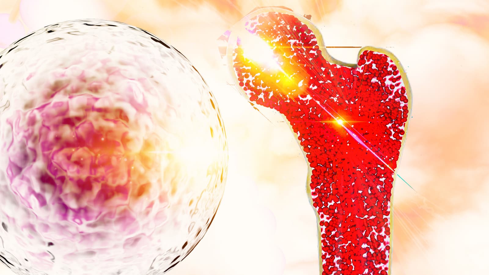 Pros & cons of bone marrow transplant