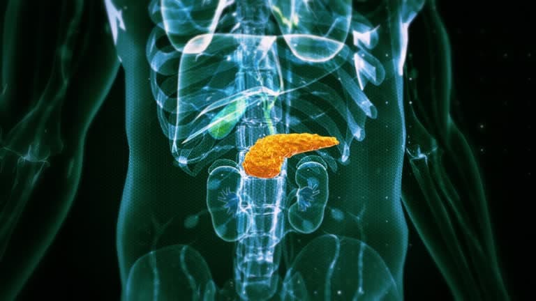 What is pancreatitis?