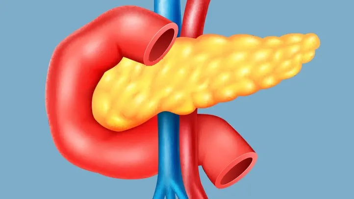 What are the different types of pancreatitis?
