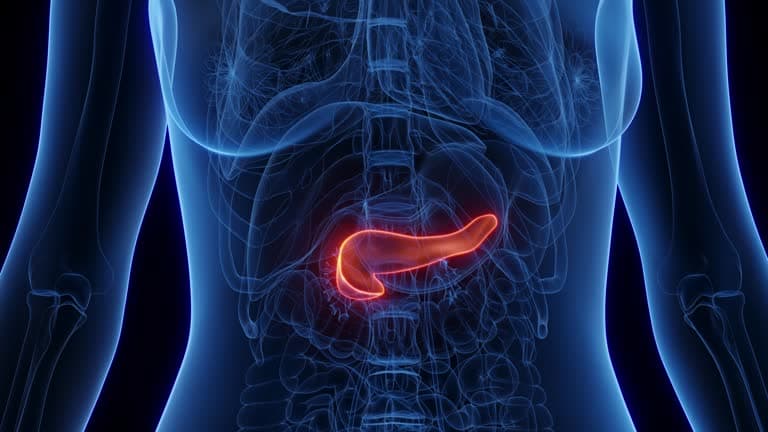 How to prevent pancreatitis?